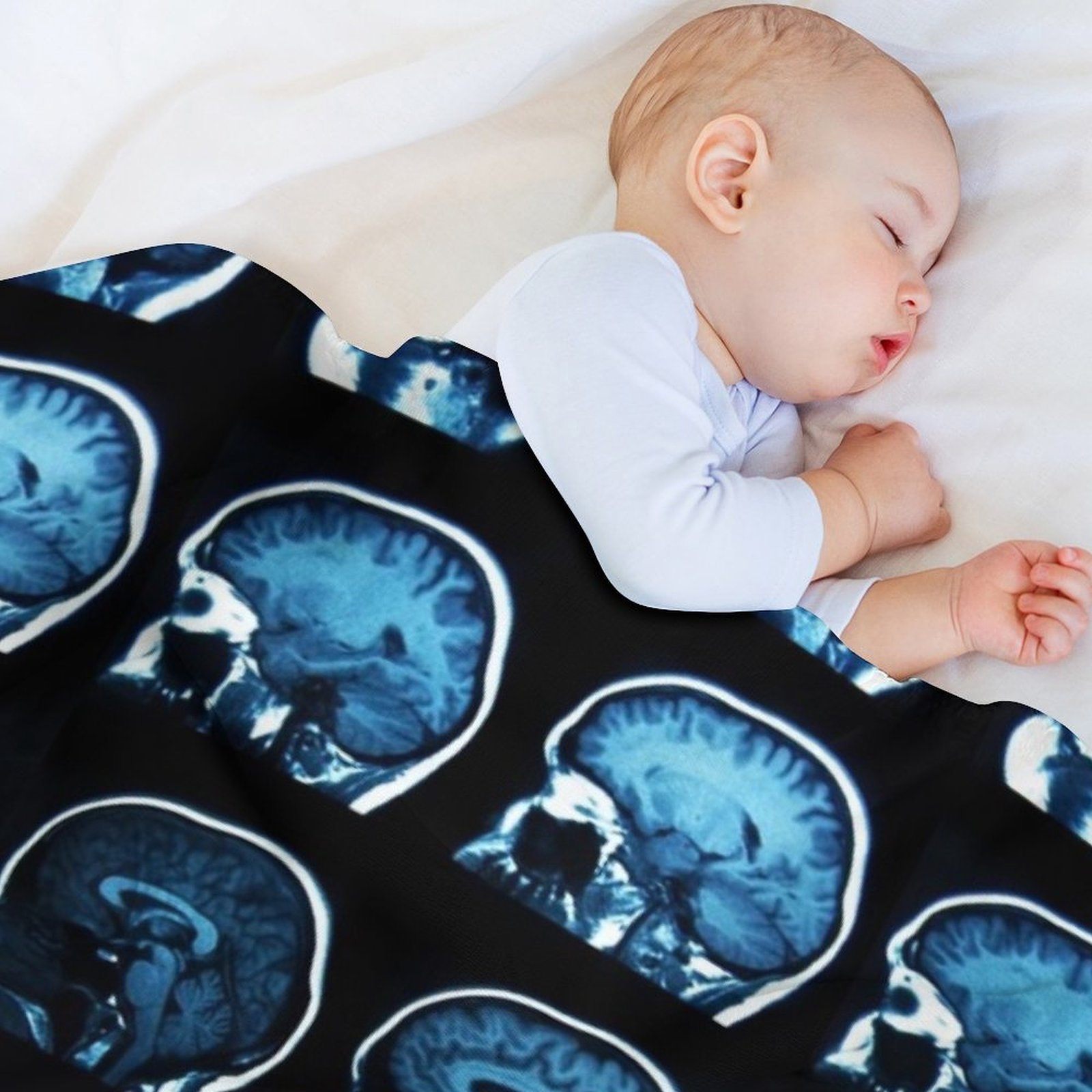 Brain MRI x-ray Throw Blanket  - 3D Printing X Ray 评论和价格